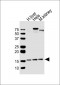 CDA Antibody (Center)