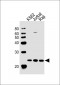 CBFB Antibody (Center)