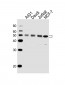 MICA Antibody (Center)