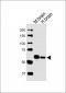 GLS Antibody (C-term)