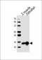 (DANRE) ba2 Antibody  (Center)