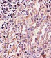 EXOC3 Antibody (C-term)