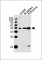 (Mouse) Dpf2 Antibody (Center)