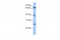 L3MBTL2 antibody - N-terminal region