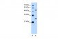BCL2L1 antibody - N-terminal region