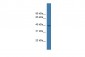 LTB4R antibody - C-terminal region