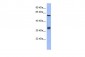 FOSL1 antibody - middle region