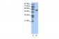 FOXC2 antibody - C-terminal region