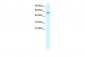 EBF3 antibody - middle region