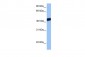 LMX1A antibody - middle region