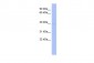 MEIS1 antibody - middle region