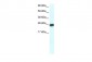 MYF6 antibody - N-terminal region