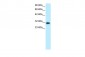 DBP antibody - N-terminal region