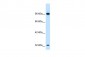 SOX30 antibody - middle region