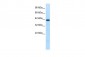 HNF1B antibody - N-terminal region