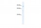 SIRT1 antibody - N-terminal region