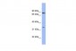 PATZ1 antibody - N-terminal region