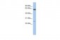 TAF5L antibody - middle region