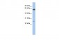 TAF5L antibody - middle region