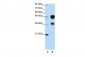FOXA1 antibody - C-terminal region