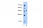 MYBL1 antibody - middle region