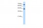 NR4A2 antibody - C-terminal region