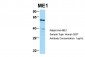 ME1 antibody - N-terminal region