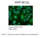 PPP1R13L antibody - middle region