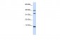 DBI antibody - N-terminal region