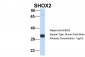 SHOX2 antibody - N-terminal region