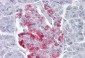 PCSK1 antibody - middle region