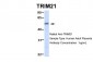 TRIM21 antibody - N-terminal region