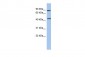 RARG antibody - middle region