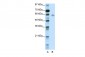 KCNG1 antibody - N-terminal region