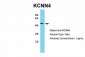 KCNN4 antibody - C-terminal region