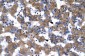 VDAC1 antibody - C-terminal region