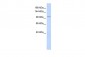 TRPC6 antibody - middle region