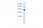 KCNK13 antibody - C-terminal region