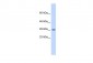 KCNN2 antibody - middle region