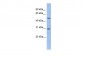 KCNIP2 antibody - middle region