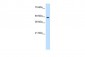 ZNF213 antibody - N-terminal region