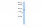 HMG20B antibody - middle region