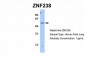 ZNF238 antibody - N-terminal region