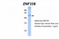 ZNF238 antibody - N-terminal region