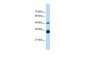 HOXC9 antibody - middle region