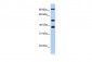 MCM3 antibody - C-terminal region