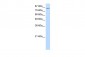 MCM7 antibody - middle region