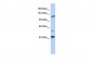 KCNH3 antibody - middle region