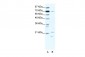 BTF3 antibody - middle region