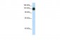 TIMELESS antibody - N-terminal region